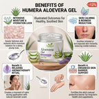 Humera Lavender Aloe Gel: Instant Solution for Dry Skin and Sunburn
